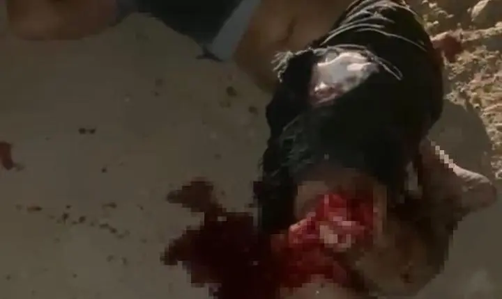 Motociclista sofre múltiplas fraturas em acidente em Delmiro Gouveia e corre risco de amputação